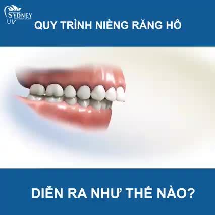 RĂNG HÔ DỊCH CHUYỂN NHƯ THẾ NÀO