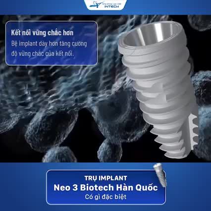 TRỤ IMPLANT NEO 3 BIOTECH CÓ GÌ ĐẶC BIỆT