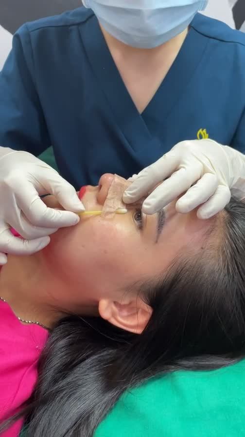 Mũi 10 ngày xinh như hotgirl cho bạn gái đến từ Nha Trang