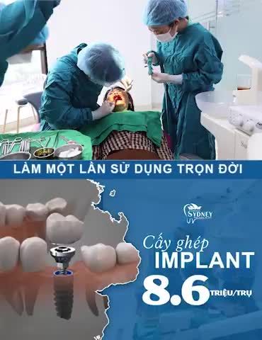 CẤY GHÉP IMPLANT TIÊU CHUẨN QUỐC TẾ