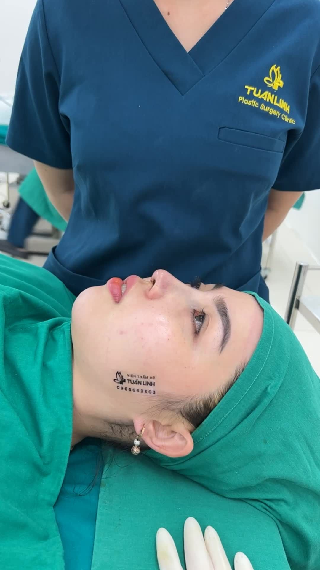 Case nâng mũi cấu trúc lên dáng nhẹ nhàng theo yêu cầu khách hàng!