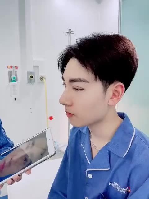 Combo cắt mí Plasma + Tạo khóe mắt trong ngoài của nam khách hàng điển trai tại BVTM Kangnam Hà Nội