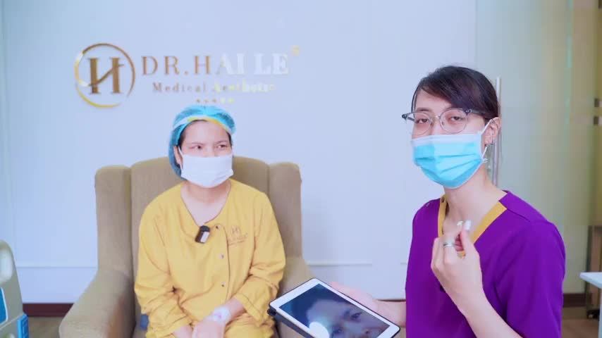 Nâng cung mày có thể giúp khách hàng trẻ hơn, rạng rỡ hơn không Mời cả nhà cùng theo dõi