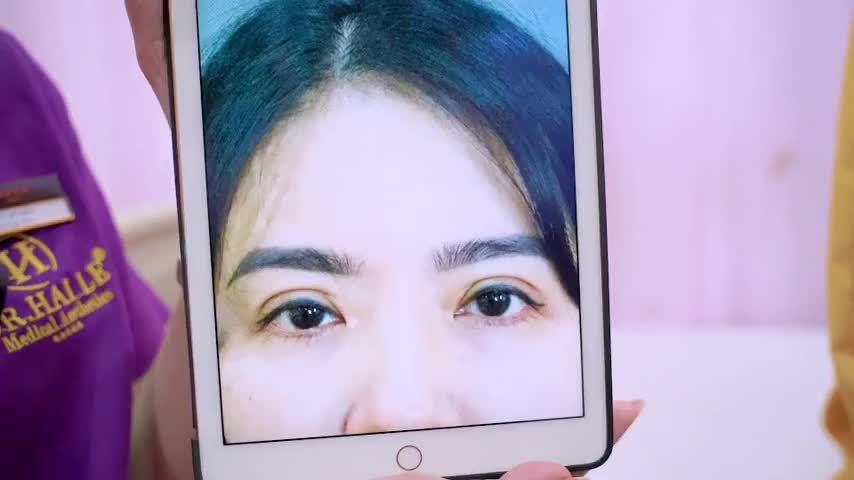 MÍ MẮT LỖI HỎNG bạn đừng quá lo lắng đến ngay Dr.Hải Lê để có giải pháp khắc phục bạn nhé