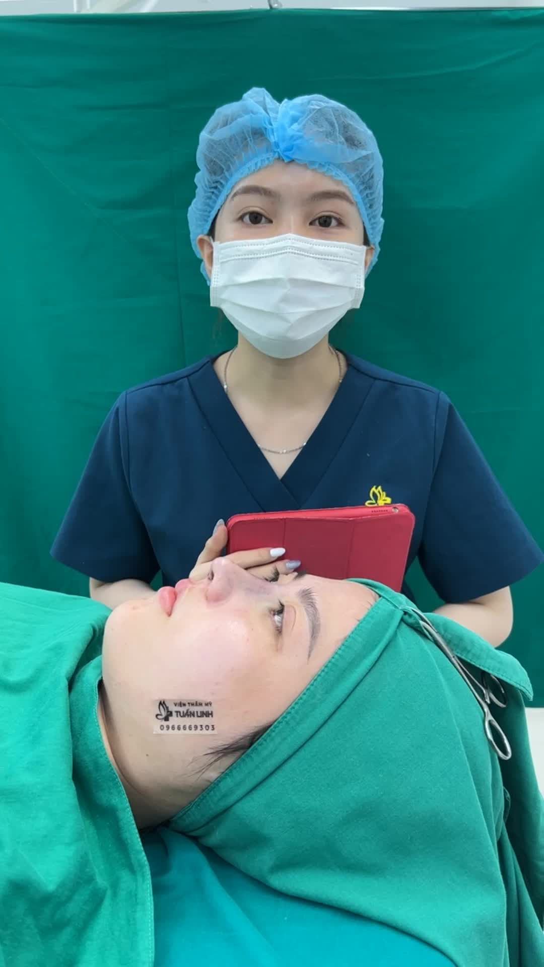 Tái tạo dáng mũi cho khách hàng từng tiêm filler