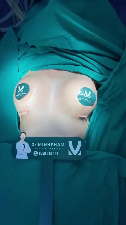 Ca Nâng Ngực Vừa Được Thực Hiện Bởi Ekip Dr. Minh Phạm