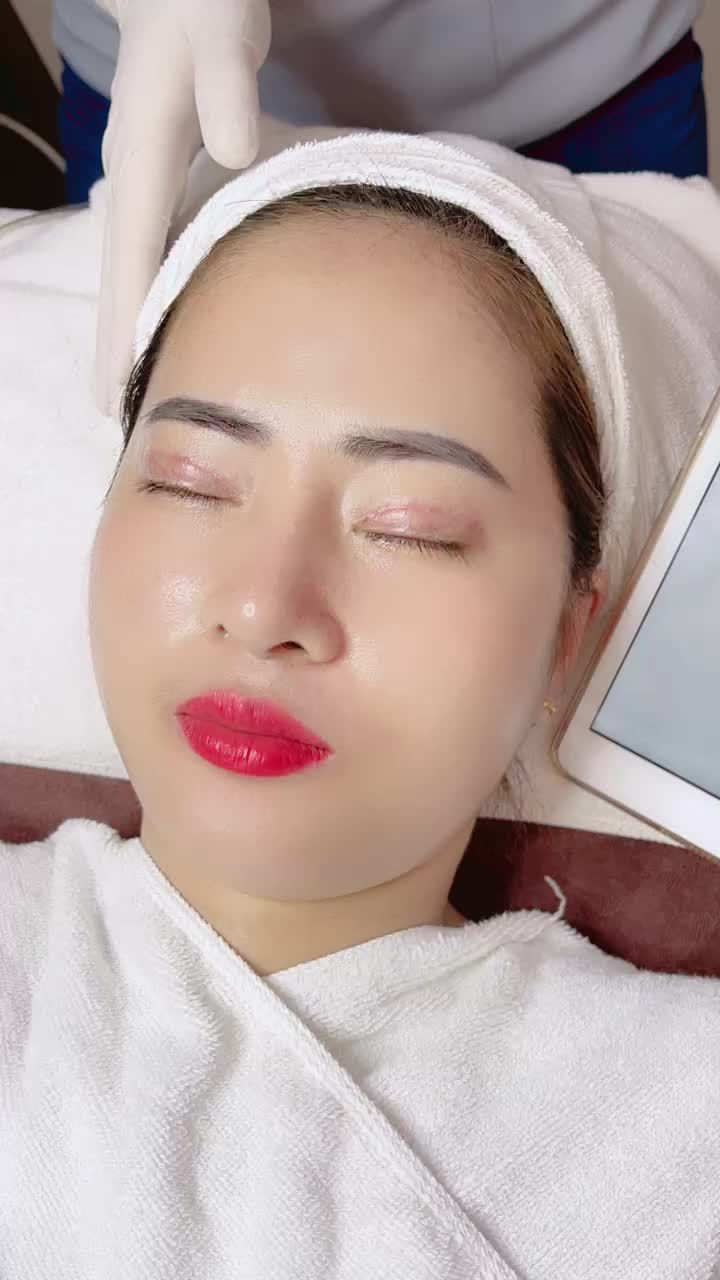 Giải pháp điều trị mụn cực ưu việt với công nghệ De-acne tại Kangnam - Sau 3 ngày đã thấy hiệu quả rõ rệt