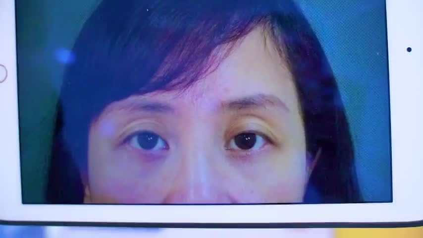 Mí mắt thiếu mỡ, hốc hác, già nua giải pháp nào khắc phục Theo dõi ngay tại video này bạn nhé