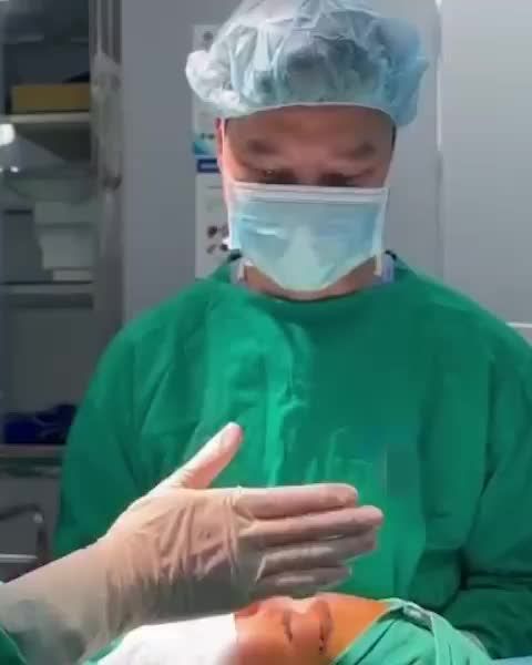 Nâng mũi vừa đẹp lại vừa an toàn tại Dr Minh Phạm!