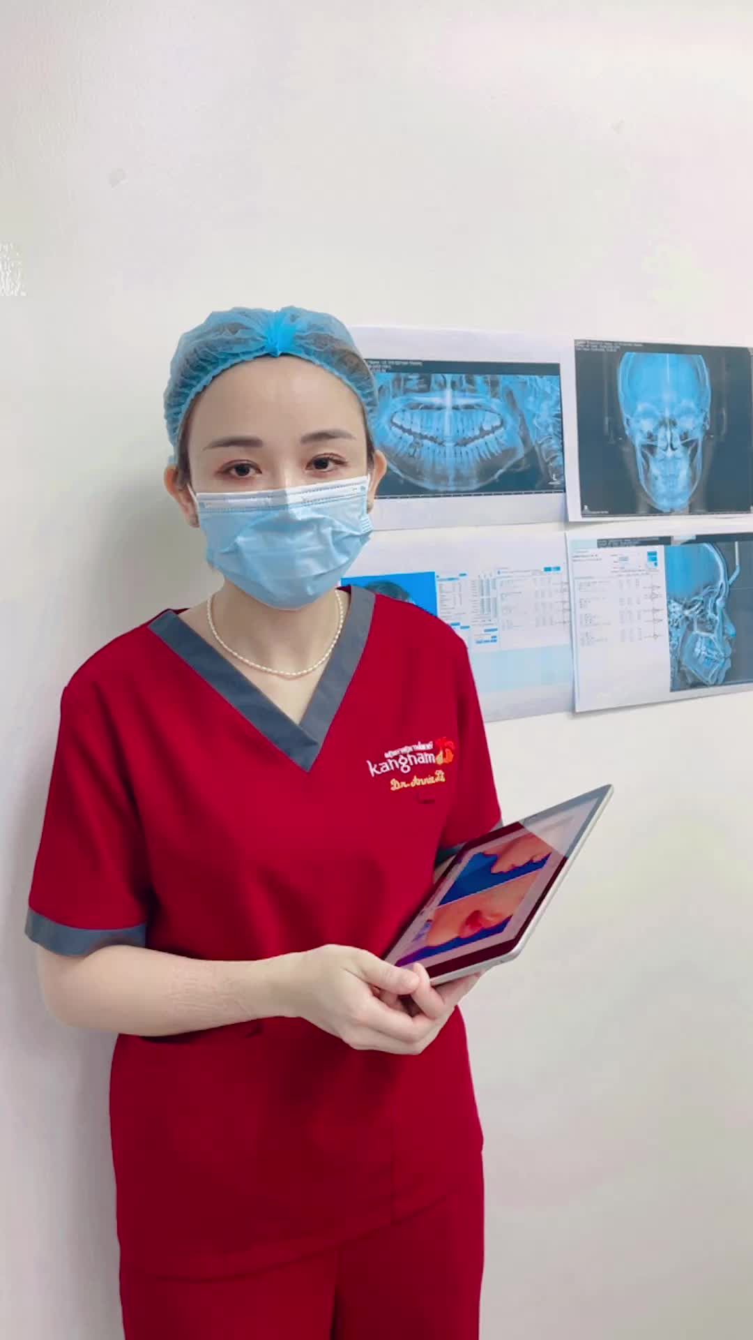 Ca phẫu thuật chỉnh hình hàm mặt tại Kangnam Hà Nội - Hàm hô được cải thiện rõ rệt, khớp cắn đều nhau