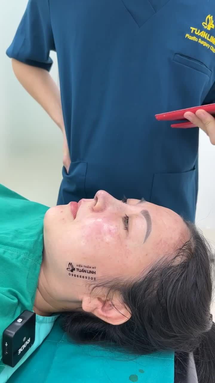 Case mũi Siêu cấu trúc cho chị gái đến từ Đồng Nai