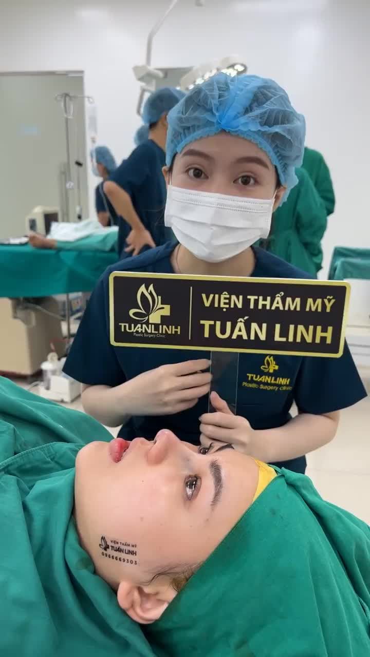 Case mũi siêu cấu trúc sụn surgiform cho em gái từ nước ngoài về