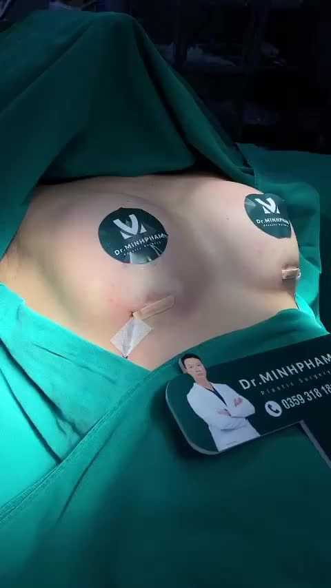 Ca Nâng Ngực Vừa Được Thực Hiện Bởi Ekip Dr. Minh Phạm