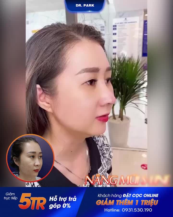 NÂNG MŨI GIẢM NGAY 5 TRIỆU - ƯU ĐÃI VÀNG THÁNG 5