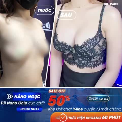 NÂNG NGỰC SAU BAO LÂU THÌ NGỰC MỀM