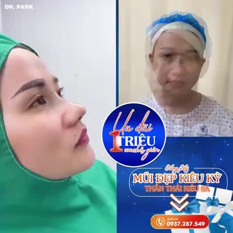 4 YẾU TỐ QUAN TRỌNG TRONG NÂNG MŨI