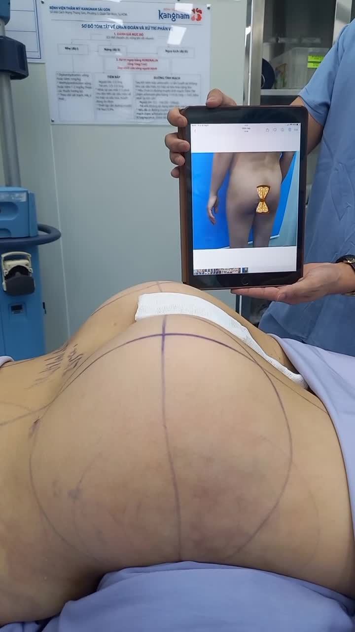 Ai tự ti vì mông lép đâu ạ