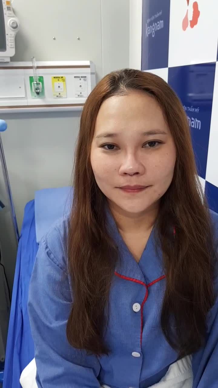 Nâng mũi Cấu trúc 4D Microform - Kết quả mong ước của nữ khách hàng
