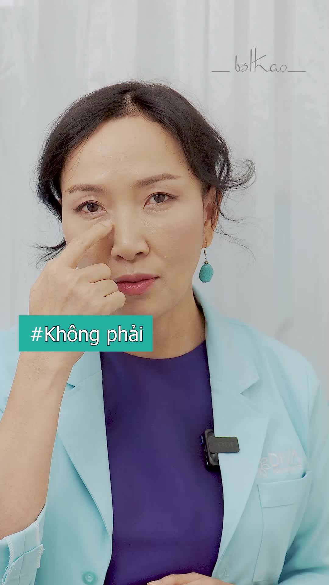 CẤY MỠ MÍ DƯỚI CÓ LÀM VÙNG MẮT NẶNG NỀ