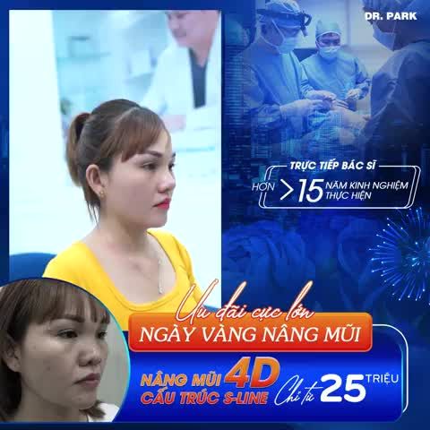 NÂNG MŨI CẤU TRÚC - PHƯƠNG PHÁP LÀM ĐẸP YÊU THÍCH NGÀY NAY