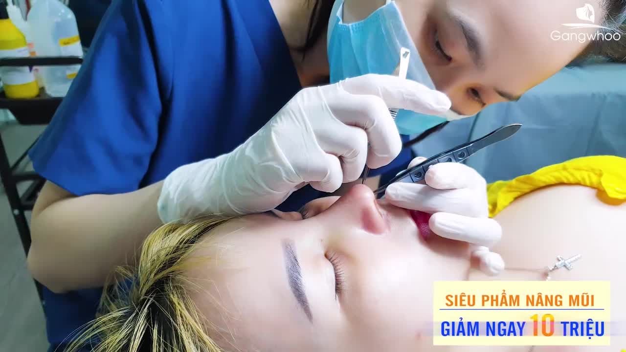 SAU NÂNG MŨI, NÊN LÀM GÌ ĐỂ MŨI ĐẸP CHUẨN