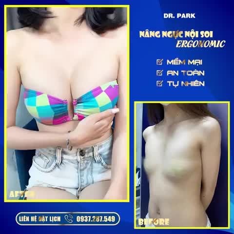 TÚI NGỰC ERGONOMIC - TỐT ĐẾN THẾ NÀO