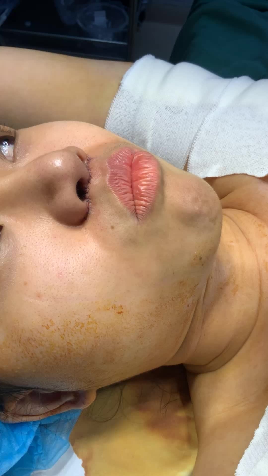 Combo cuối ngày là thu ngắn nhân trung xử lý vấn đề mùi ở nách mà mùa nóng ntn thì rất khó chịu í ...