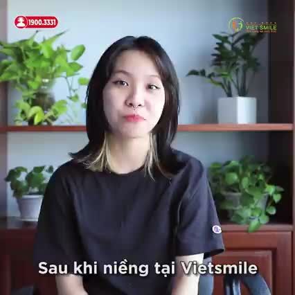 SAU 1 NĂM NIỂNG RĂNG TẠI VIET SMILE CÓ THAY ĐỔI RA SAO