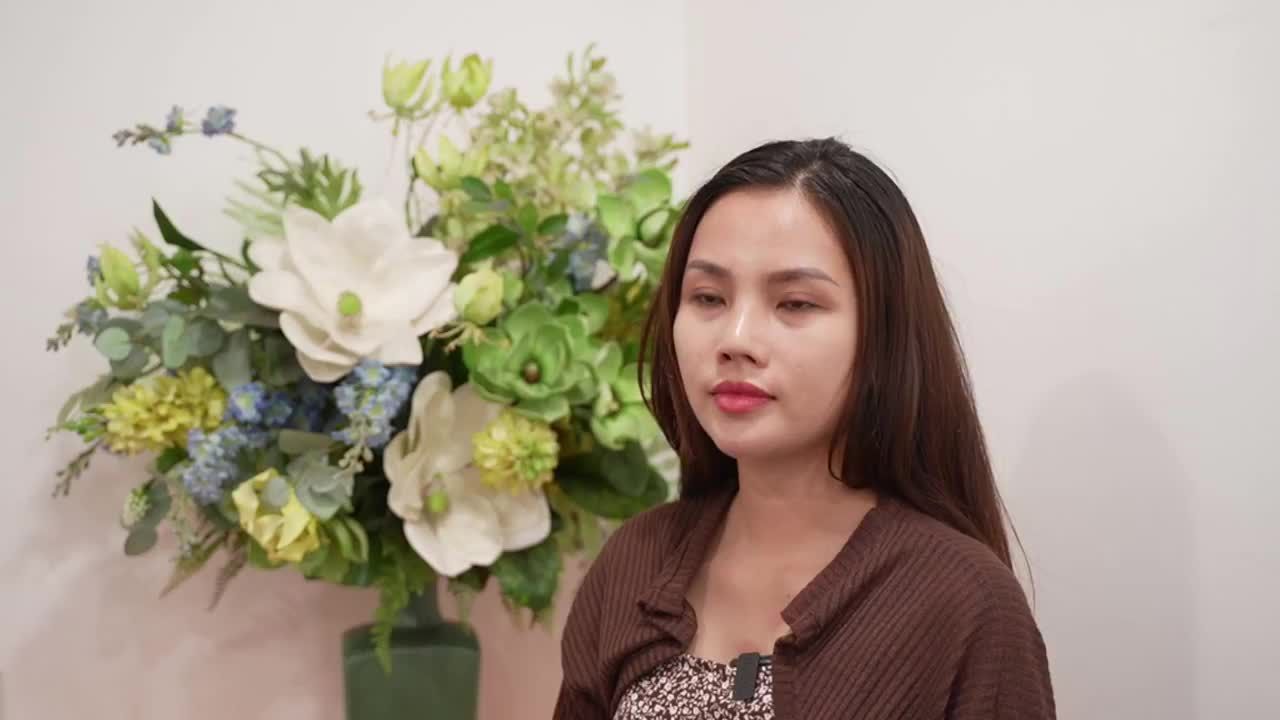 Tái khám sau 1 tháng tái tại mũi hỏng