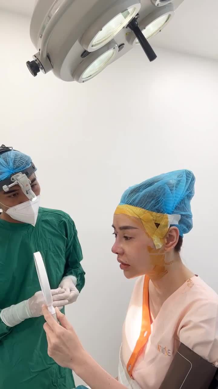 Khắc phục tình trạng mũi ng.ắ.n cho khách hàng từng nâng mũi nhân tạo
