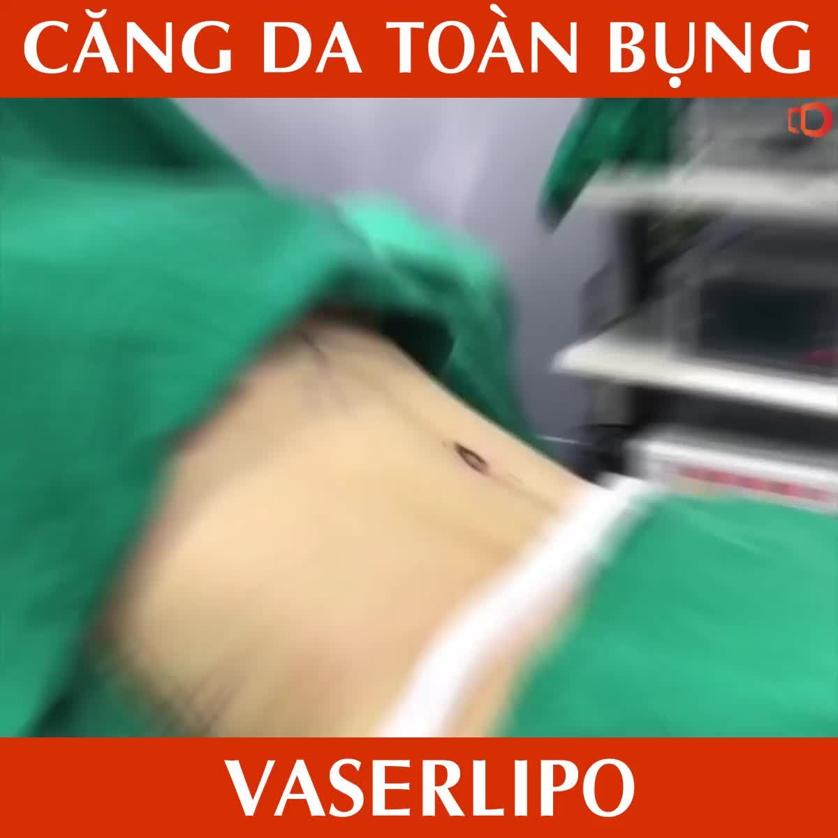 CHỈ 60 PHÚT, BỤNG TO KHÔNG CÒN LÀ NỖI LO