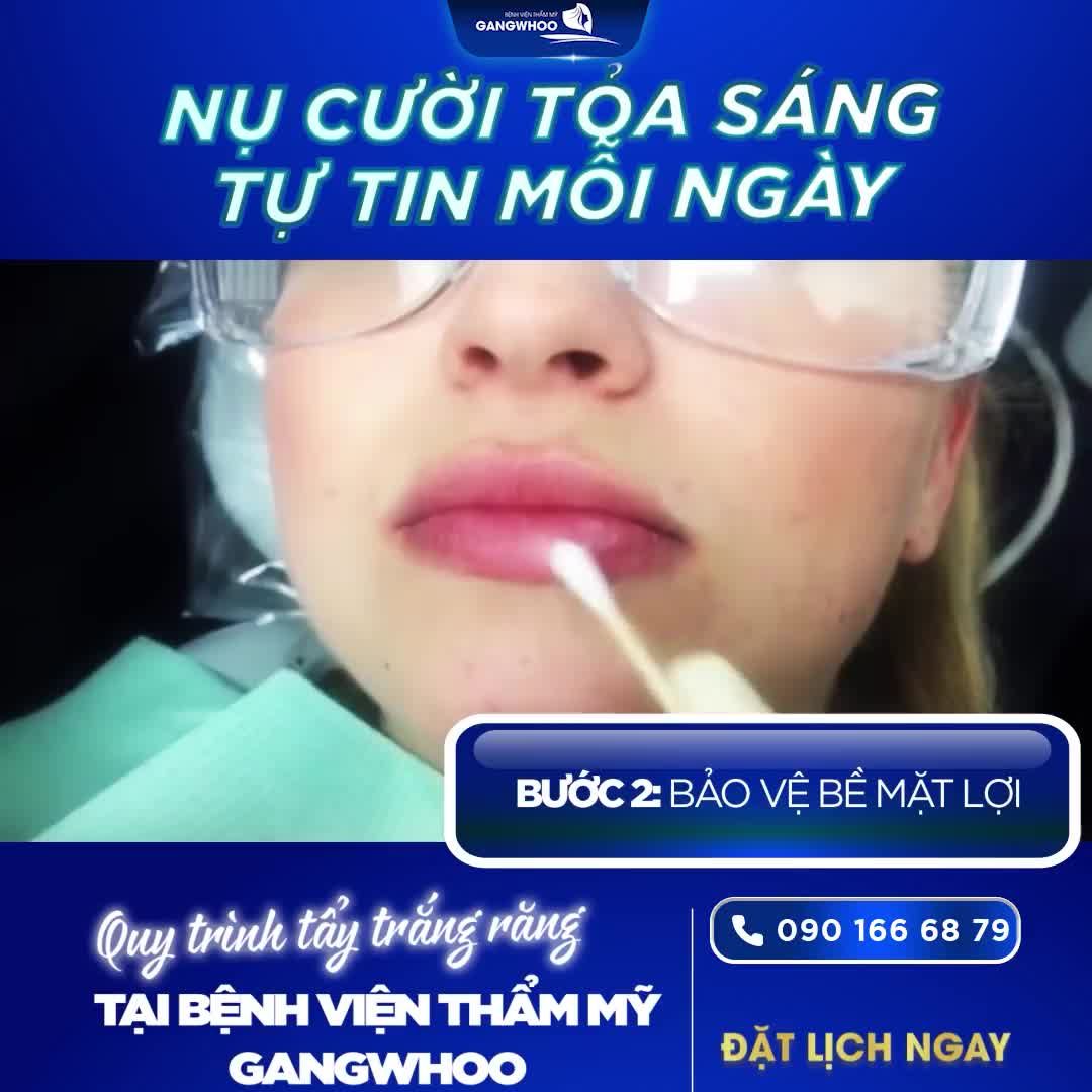 BẬT MÍ TẤT TẦN TẬT VỀ QUY TRÌNH TẨY TRẮNG RĂNG TẠI BVTM GANGWHOO
