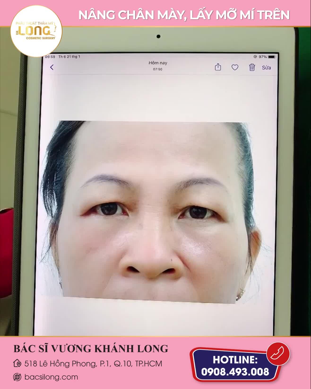 LÃO HÓA CỠ NÀO CŨNG CHẤP HẾT