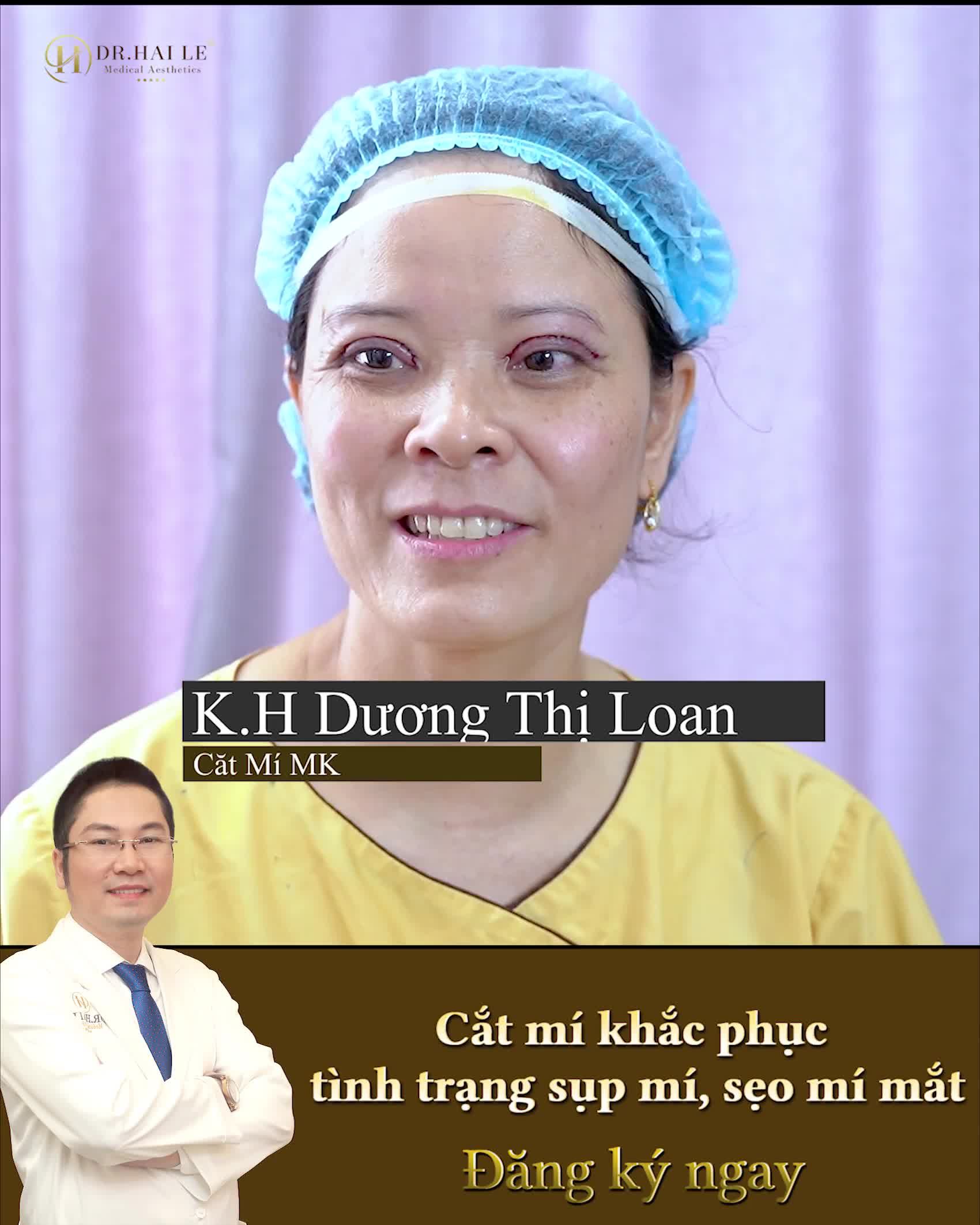 Quyết định đi cắt mí khi nghe bạn bè review về Dr.Hải Lê