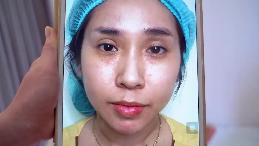 Tin vui cho khách hàng khu vực phía Nam  Nếu mắt bạn lỗi hỏng đến ngay Dr.Hải Lê cơ sở HCM để được bác sĩ tìm giải pháp khắc phục tốt nhất bạn nhé