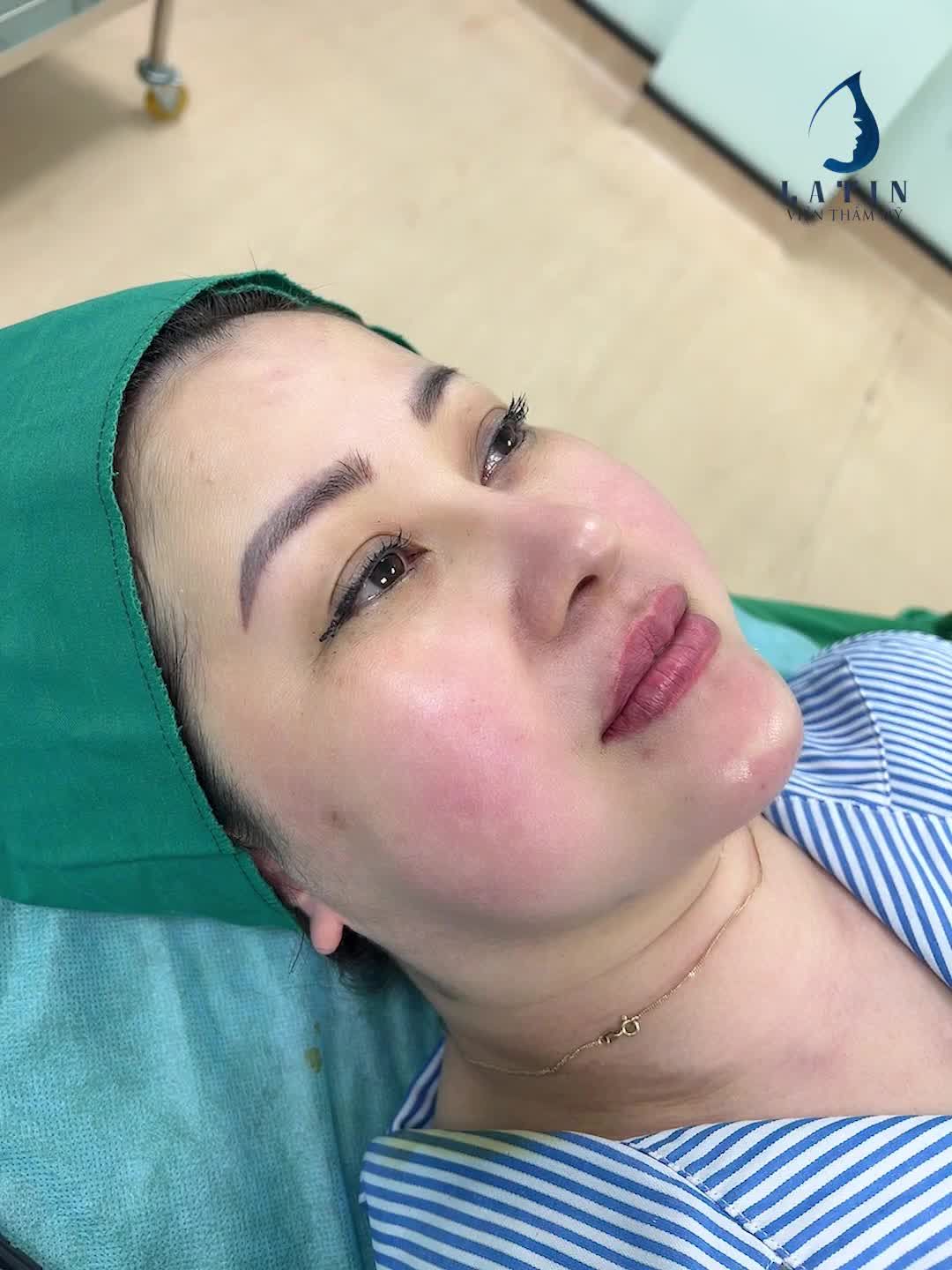 Khách hàng cũ từ Phần Lan về Latin độn cằm.
