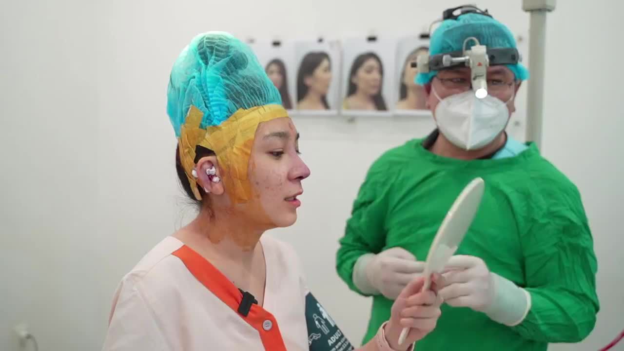 Ca nâng mũi cấu trúc sụn tai