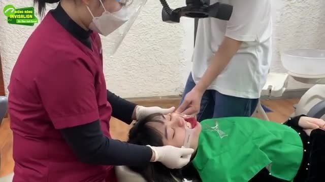 TRẢI NGHIỆM NIỀNG RĂNG INVISALIGN TỪ A-Z