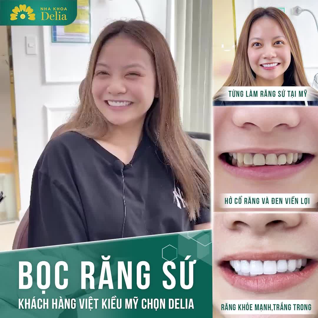 KH Đào Thị Như Ý (Việt Kiều Mỹ) tin tưởng Delia để BỌC RĂNG SỨ