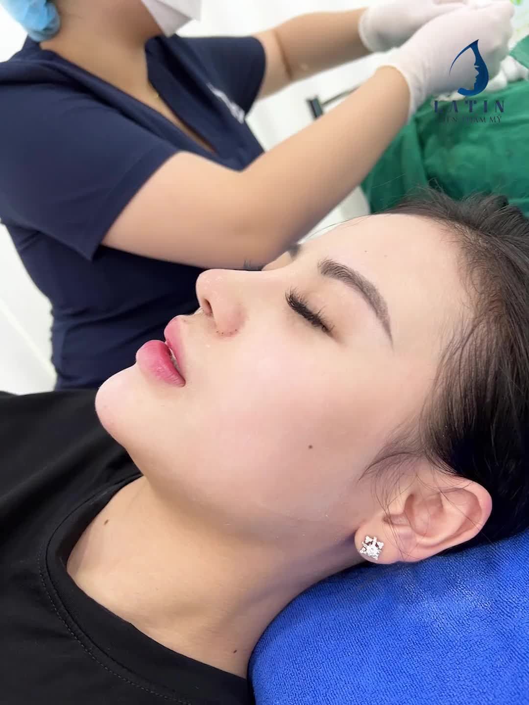 MŨI ĐẸP XINH - TRIỆU ÁNH NHÌN