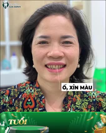Chia sẻ chân thật của Nguyễn Thị Nhạn sau khi trải nghiệm dịch vụ răng sứ thẩm mỹ tại Nha khoa Gia Đình