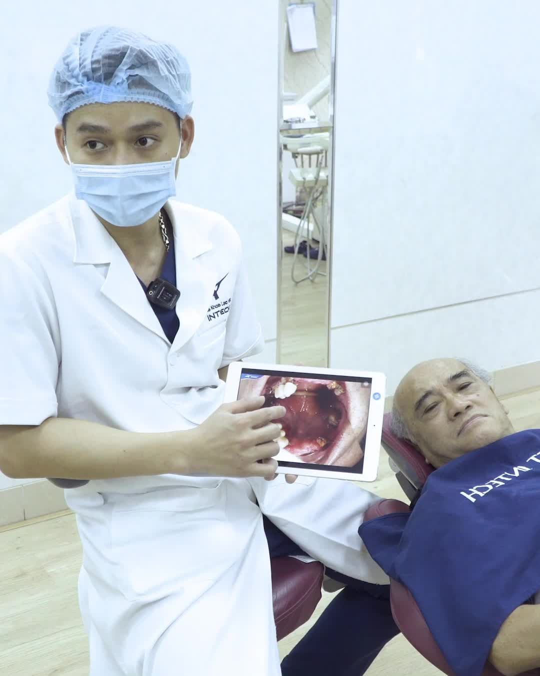 trồng răng implant All - on - 6