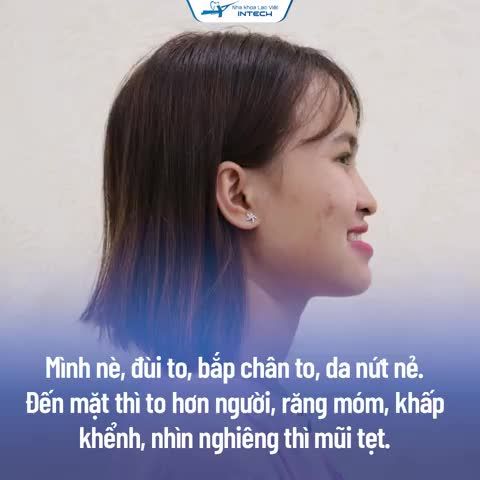 “Niềng răng – Quyết định đúng đắn nhất cuộc đời tôi…”