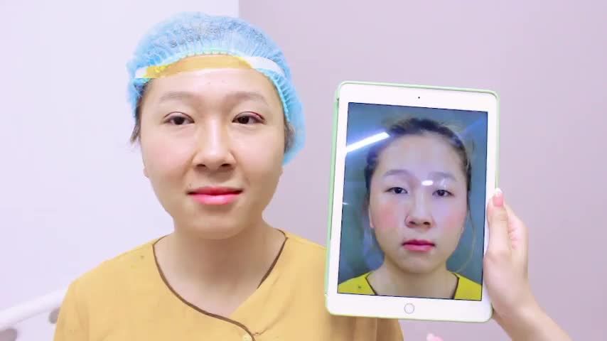 Mắt một mí trở thành hai mí trông gương mặt sẽ khác như thế nào