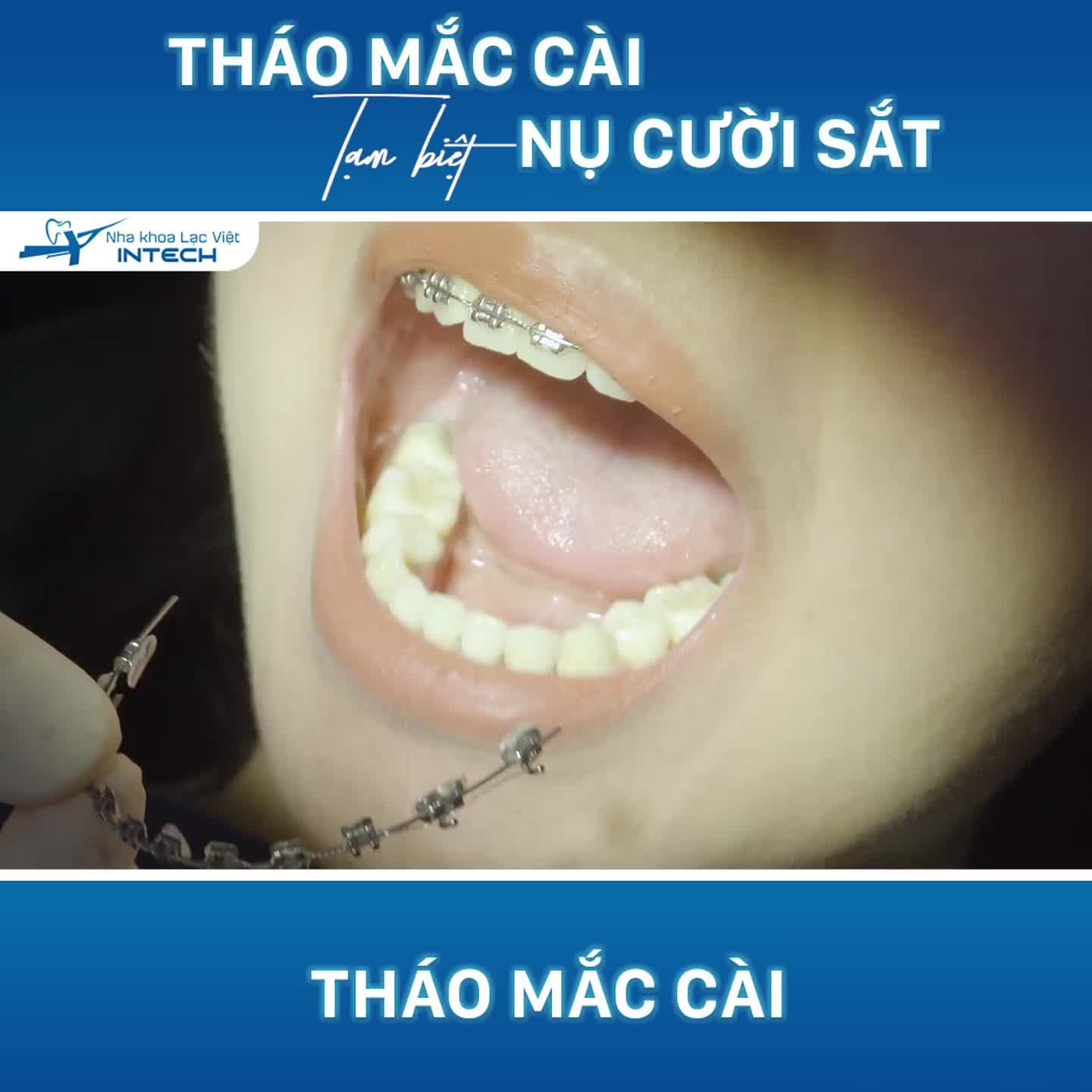 THÁO MẮC CÀI – TẠM BIỆT NỤ CƯỜI SẮT