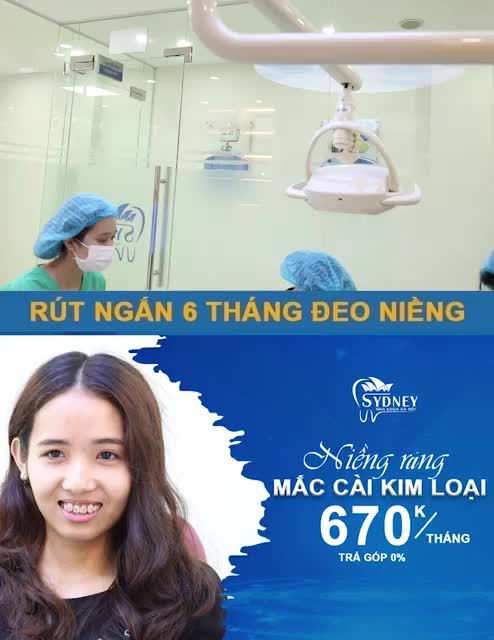 BẬT MÍ CÁCH LỰA CHỌN NIỀNG RĂNG KIM LOẠI