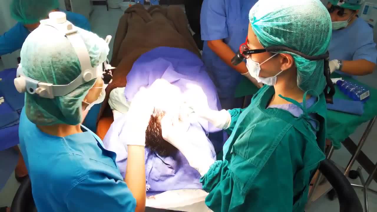 Bác sĩ "trồng" tỉ mỉ từng nang tóc vào vùng hói