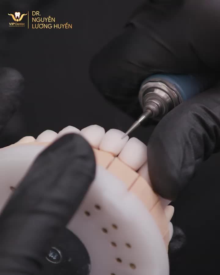 ĐẰNG SAU NHỮNG NỤ CƯỜI TUYỆT TÁC VIP DENTIST