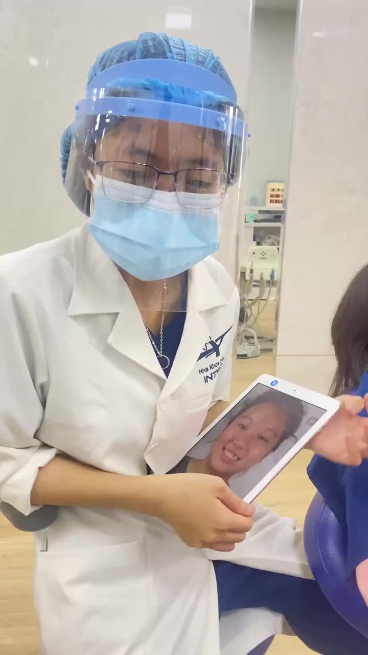 GẮN HÀM DUY TRÌ CHO KHÁCH HÀNG NIỀNG RĂNG MÓM, KHỚP CẮN NGƯỢC
