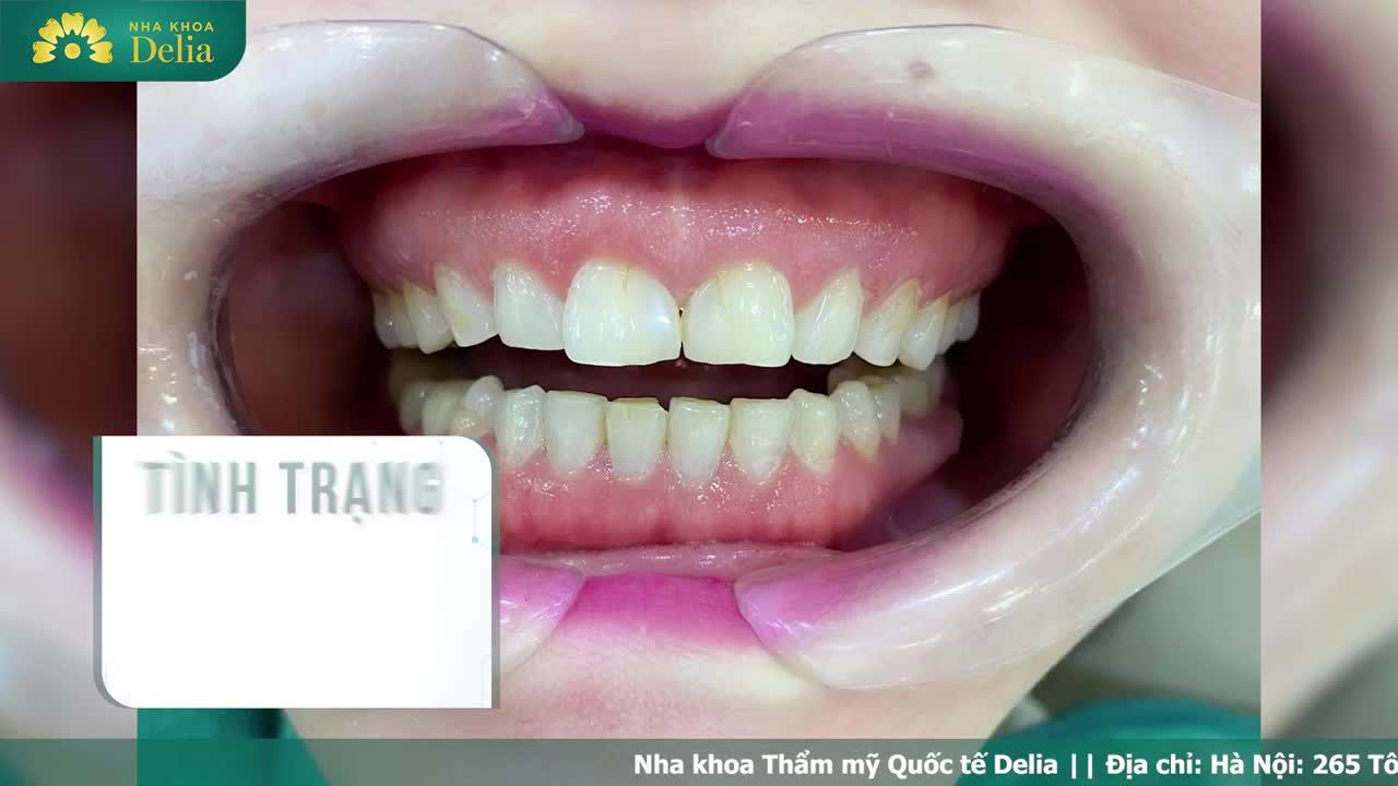 KH Mai Hương (Việt kiều Singapore) đến với Delia
